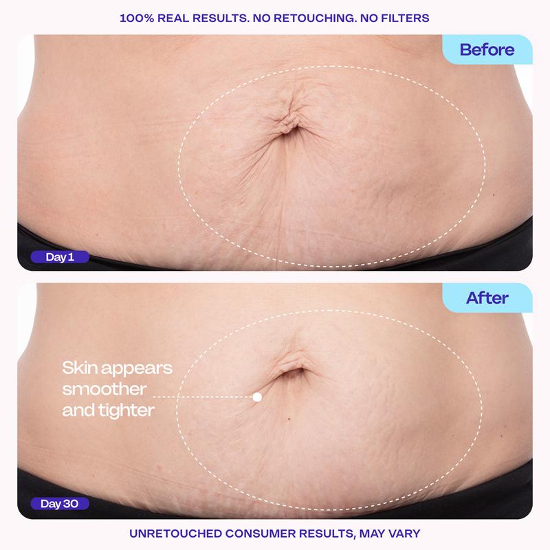 Belly Firming Cream