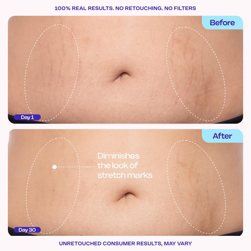 Belly Firming Cream