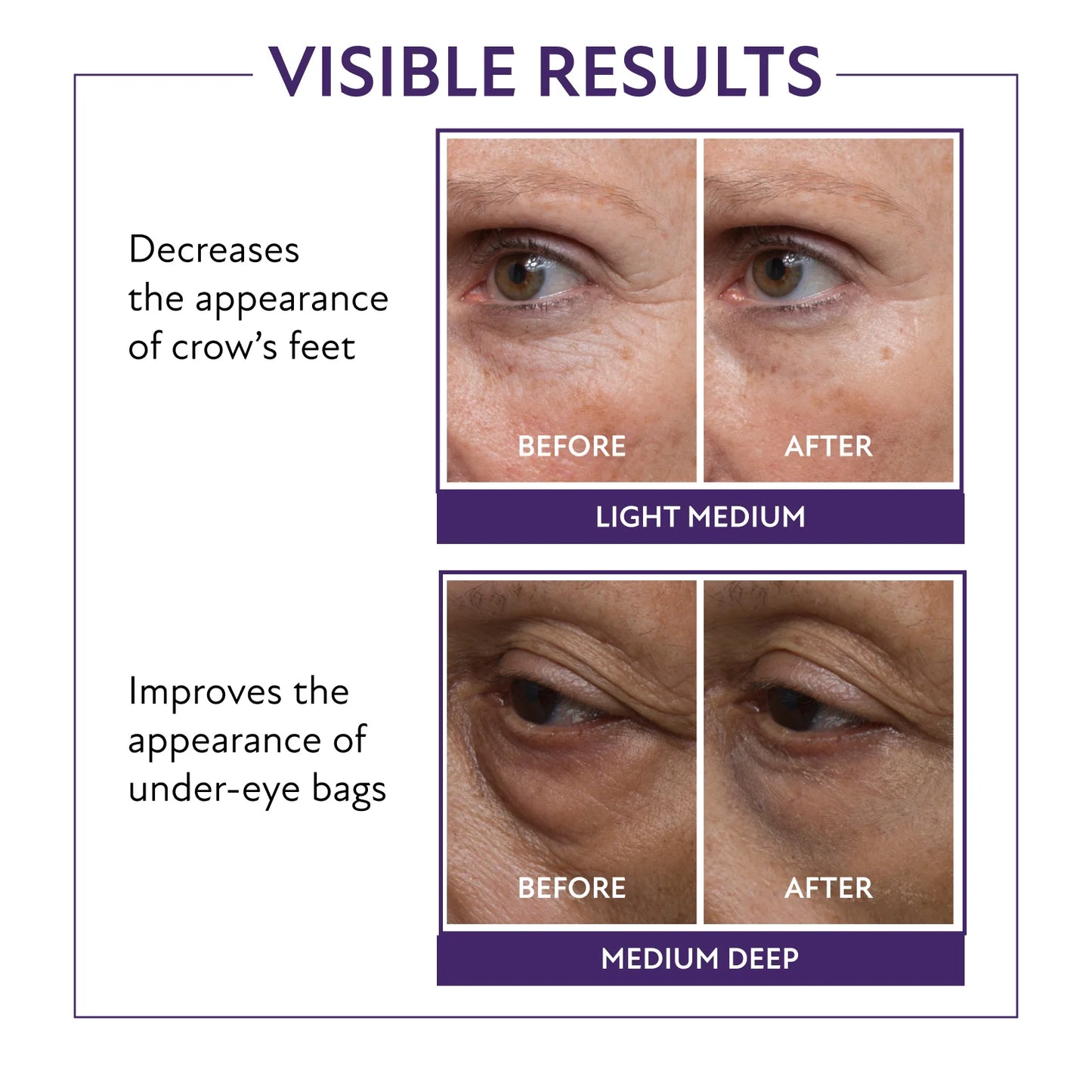 Eye Firming Gel