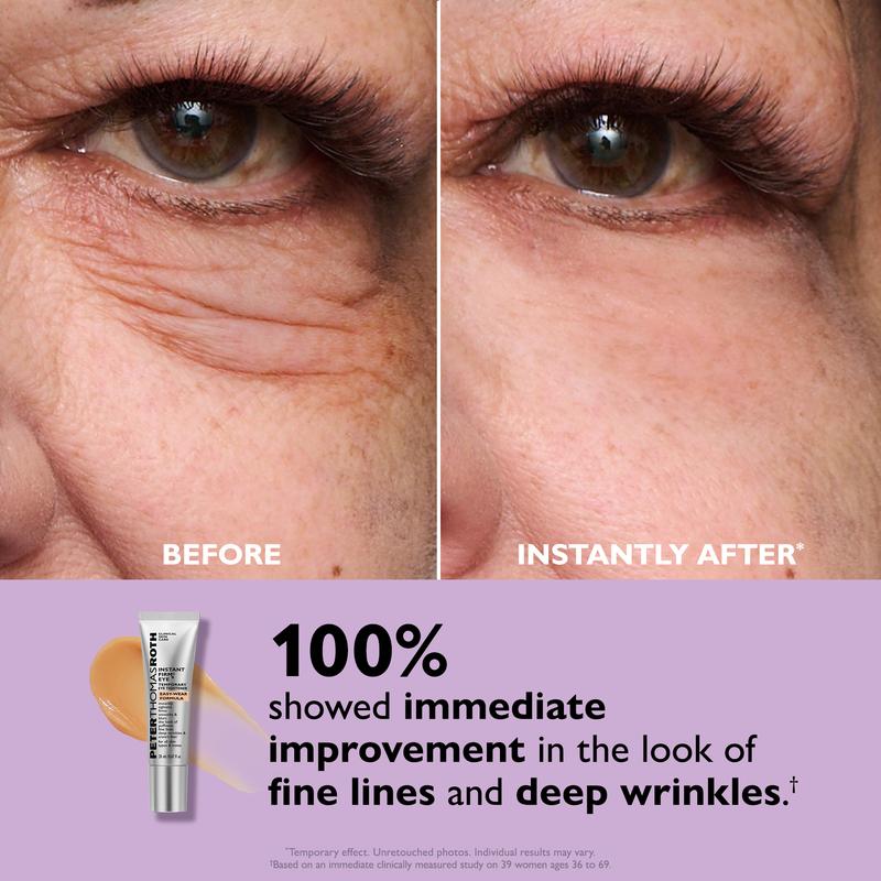 Total Eye Tightening Cream