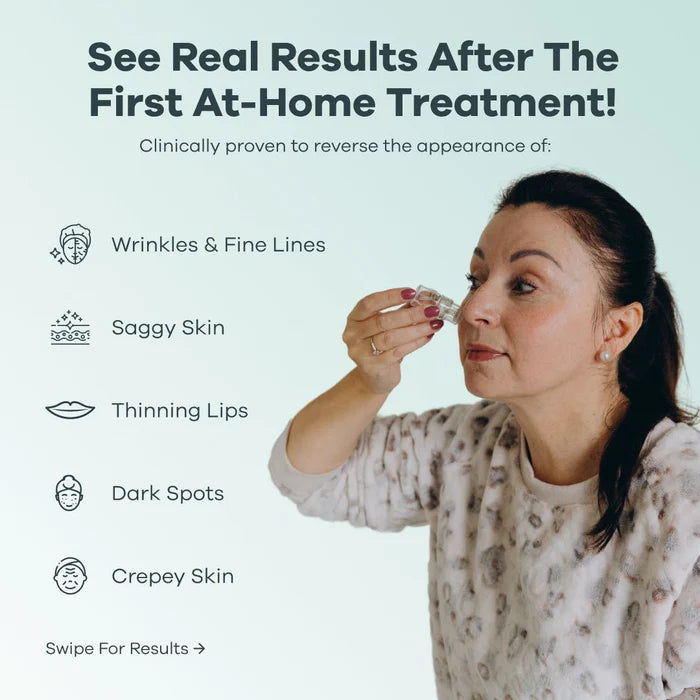 The Microneedling Infusion System
