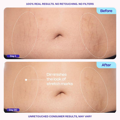 Belly Firming Cream