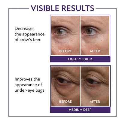 Eye Firming Gel