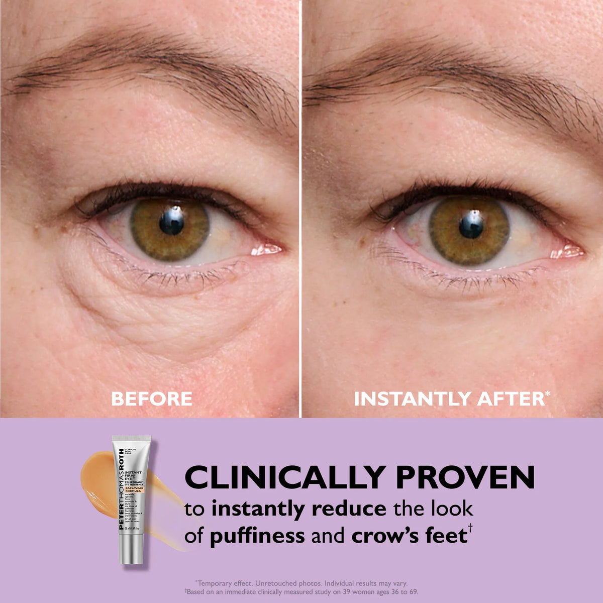 Total Eye Tightening Cream.