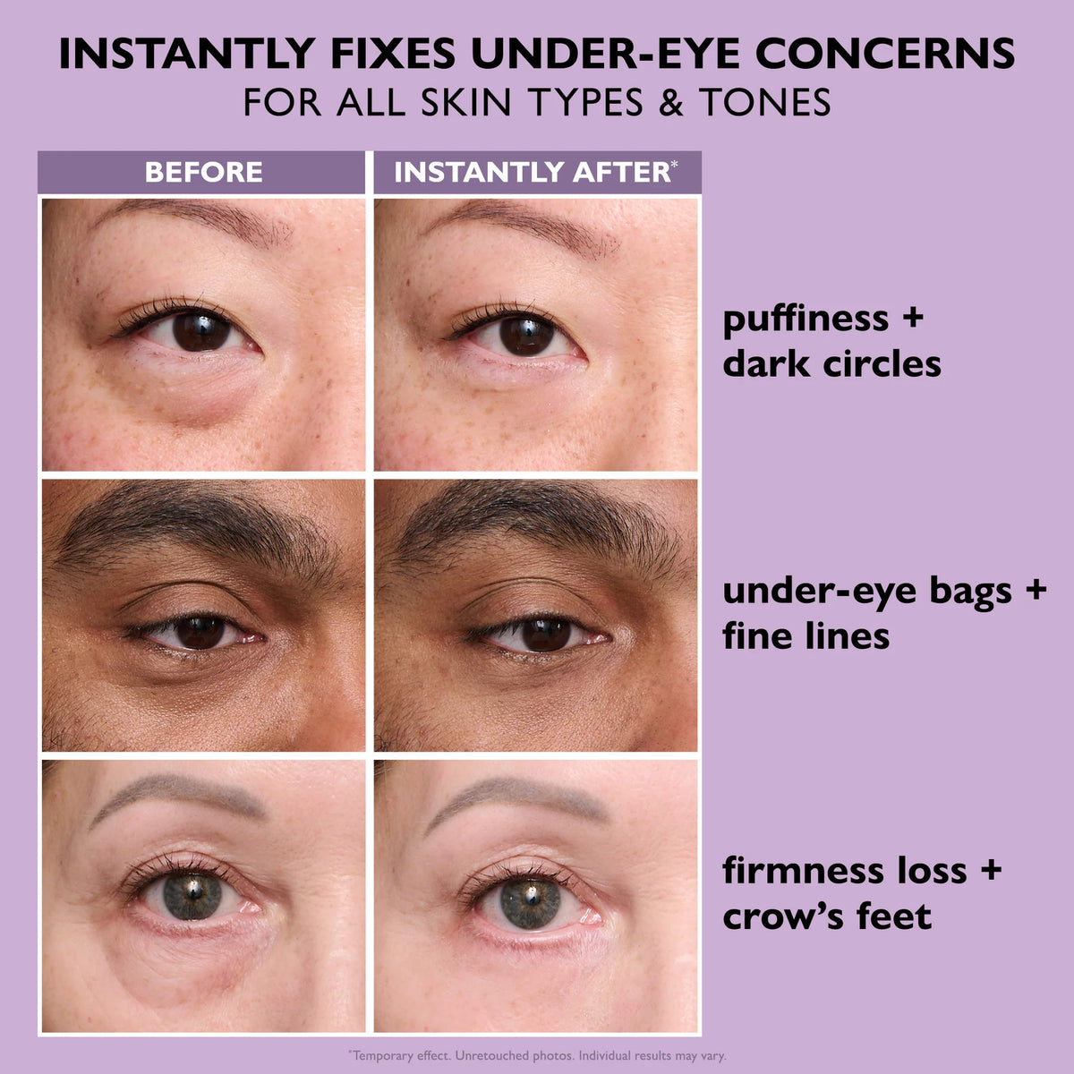 Total Eye Tightening Cream.