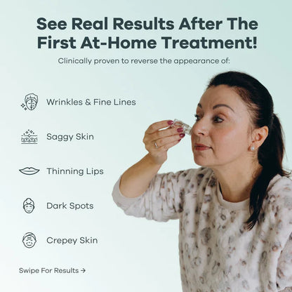 The Microneedling Infusion System